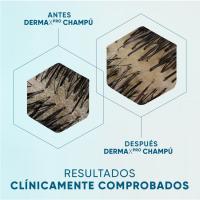 Champú calmante H&S DXP, dosificador 800 ml